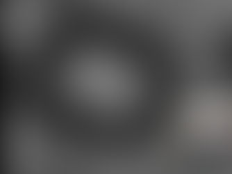 Observations inquiétantes dans le sang des vaccinés ARNm