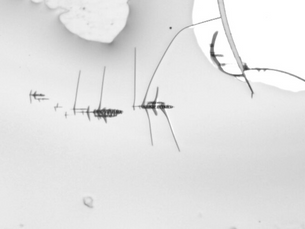 Dr Aventin : l’oxyde de graphène dans les vaccins se retrouve dans le placenta 15' après l’injection