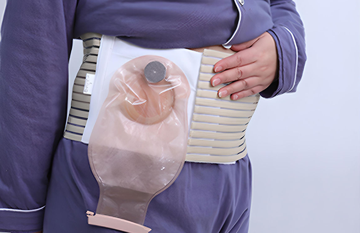 Medical & Sterile Supplies Colostomy