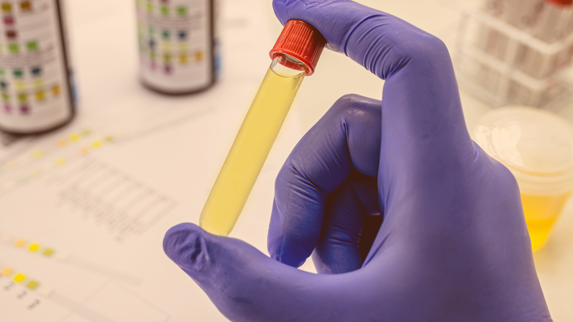 TOXICOLÓGICO URINA ESTENDIDO