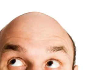 Saç Dökülmesini ve Erken Beyazlamayı Tetikleyen İki İçecek ve Önlemler