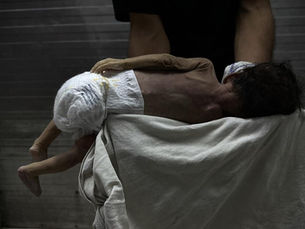 Gazze'de Açlık Nedeniyle 13 Kişi Daha Hayatını Kaybetti