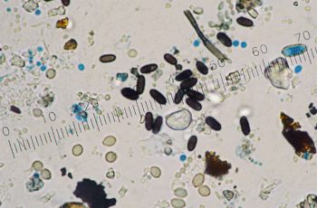 Mold under Microscope