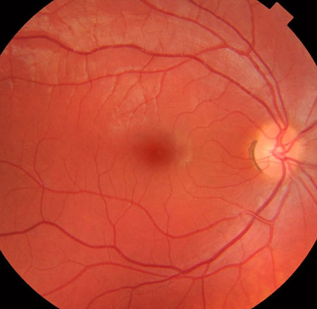 RETINA_edited.jpg