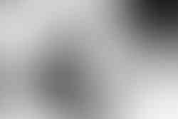 Male PRP for hair loss