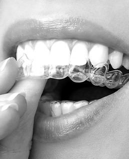 Clear Dental Aligner_edited.jpg