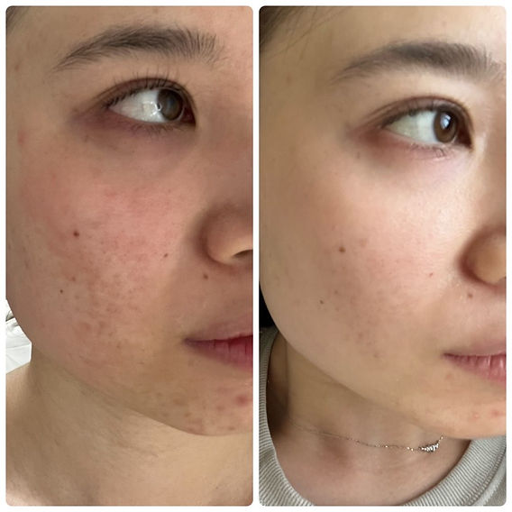 素肌美人になれるスキンケア