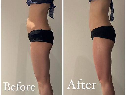 ぽっこりお腹が気になるあなたへ