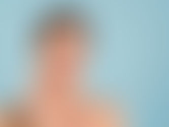 Microneedling before botox results