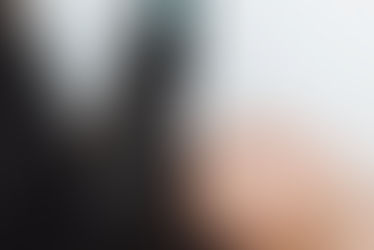 Microneedling Service