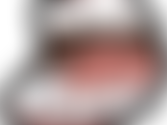 마비말장애의 언어치료는 어떤 방법으로 할 수 있나요?