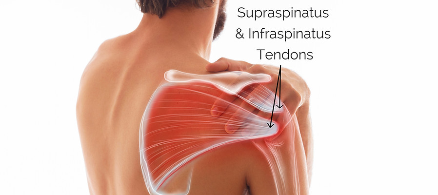 Man's shoulder pain, muscle and body str