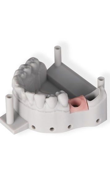 Druk 3D Dental Olsztyn