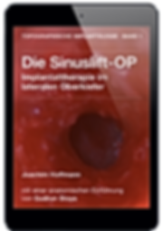 Sinus lift aplikacja Joachim Hoffmann