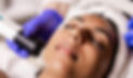 dermaspark radio frequency - Google Search_edited_edited_edited.jpg
