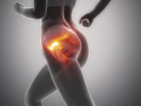 How Hip Pain Can Offset Your Balance During Runs (And What You Can Do About It)