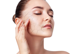 Winter Skin Doesn’t Have to Mean Dry Skin