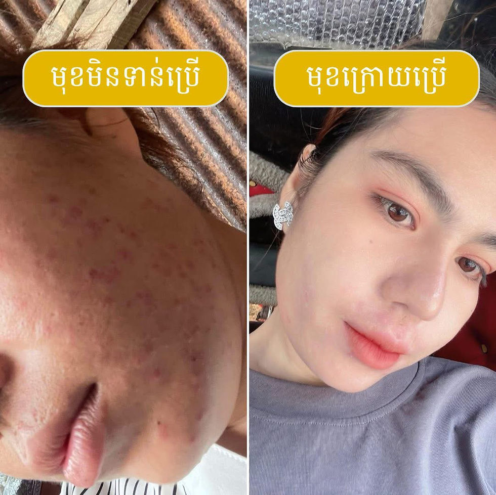 Thumbnail: Sakura Serum Anti~Melasma Brightening 