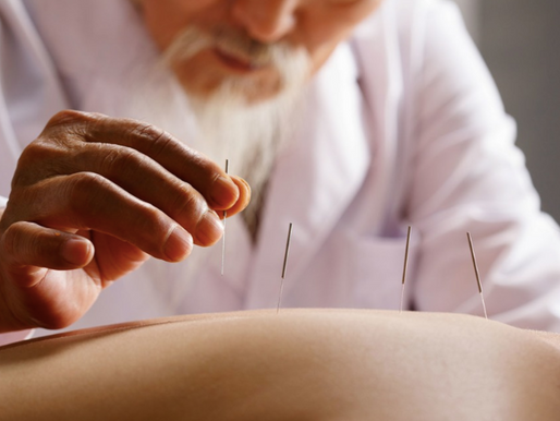 L'acupuncture (针灸 zhēn jiǔ)