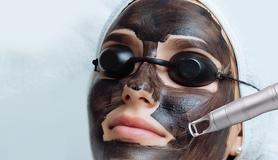 CARBON LASER PEEL .jpg