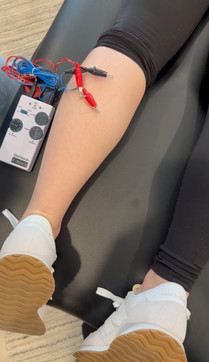 Calf muscle dry needling