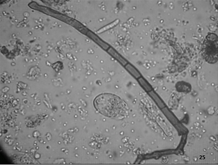 פיטריה במיקרוסקופ