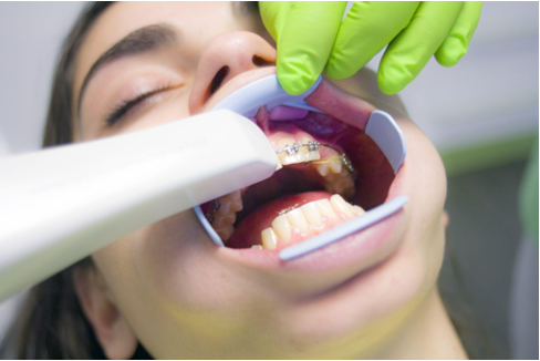Dental Braces Check-up
