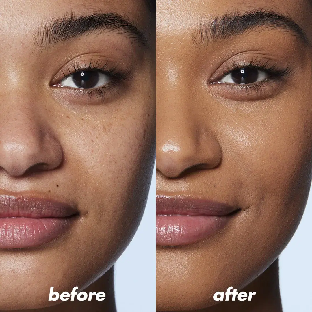 Comparativa antes/después del rostro en campaña Vita Jelly Mist Serum