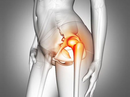 Expert Tips for Smooth Healing After Total Hip Replacement Surgery in Delhi