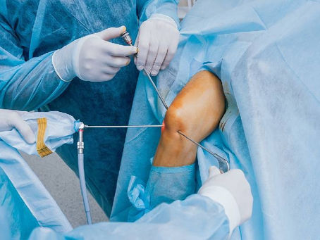 Arthroscopy Surgery Delhi: Quick Recovery with Minimally Invasive Techniques