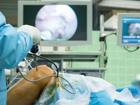 Arthroscopy Surgery Delhi for Joint Pain: Everything You Should Know
