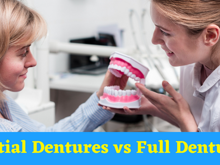 Partial Dentures vs Full Dentures: Which Is Right for You?