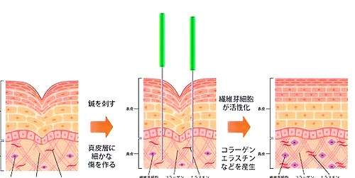 image_123650291_edited.jpg
