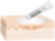 Crystaderm First Aid Cream 15g