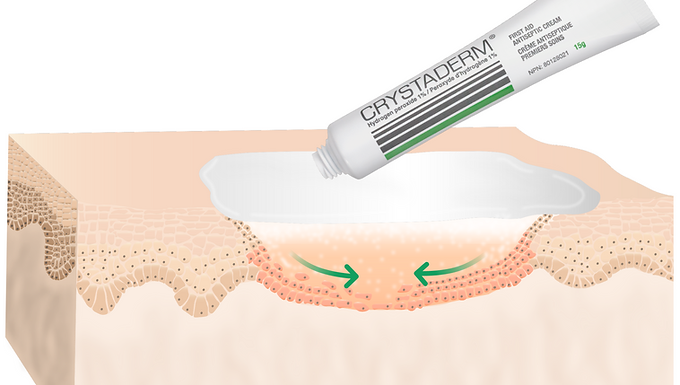 Crystaderm First Aid Cream 15g
