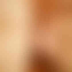 Credit: @thehillsspa.byskin