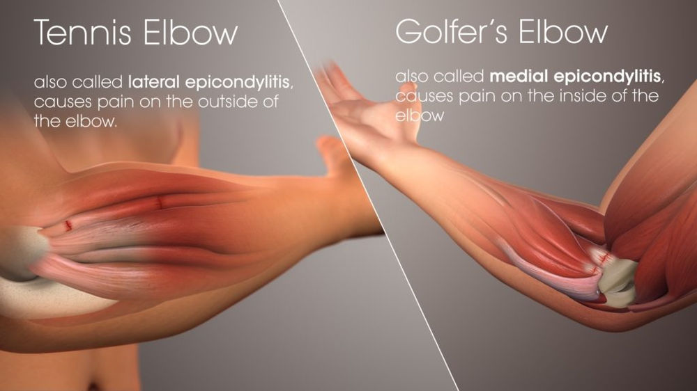 Know Your Elbow know-your-elbow