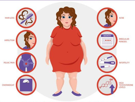 PCOS Is Not Caused By Weight Gain