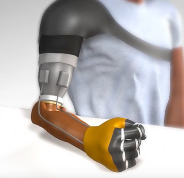 upper-limb prosthetics.png