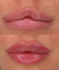 microblad ok site 2.png