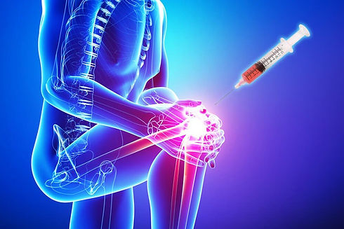 Arthritis-PRP-Stem-Cell-Therapy-Image-PR
