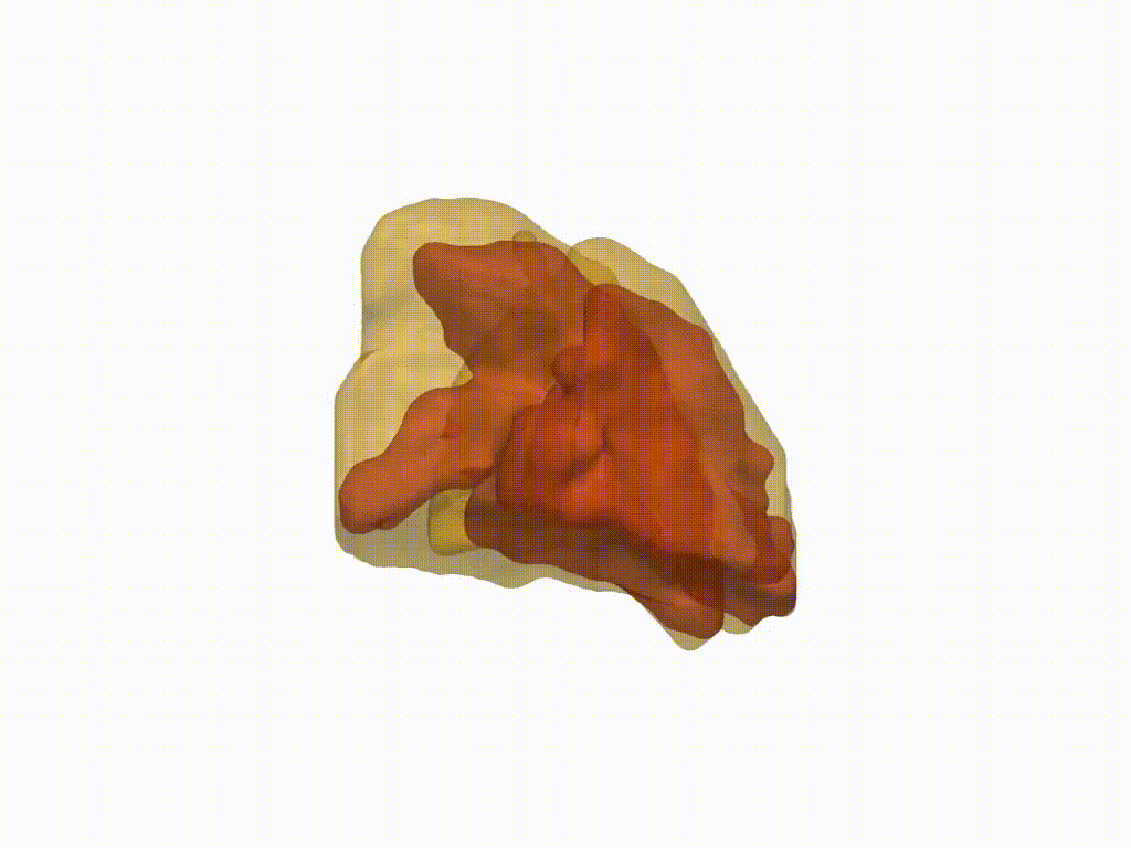 Lung7.gif