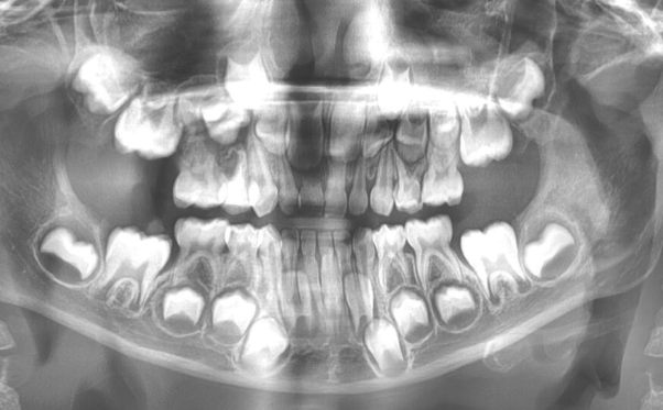 Woman Smiling at Dentist_edited.jpg