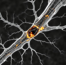 When Your Body Attacks Its Own Nerves: Understanding Guillain–Barré Syndrome (GBS)