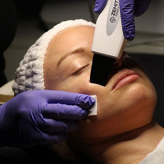 ULTRASOUND DEEP CLEANING