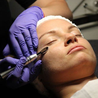 Electroporation Skin Hydration