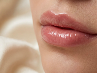 At Lip Filler at Beverly Hills Wellness Center & Med Spa in West Palm Beach, FL