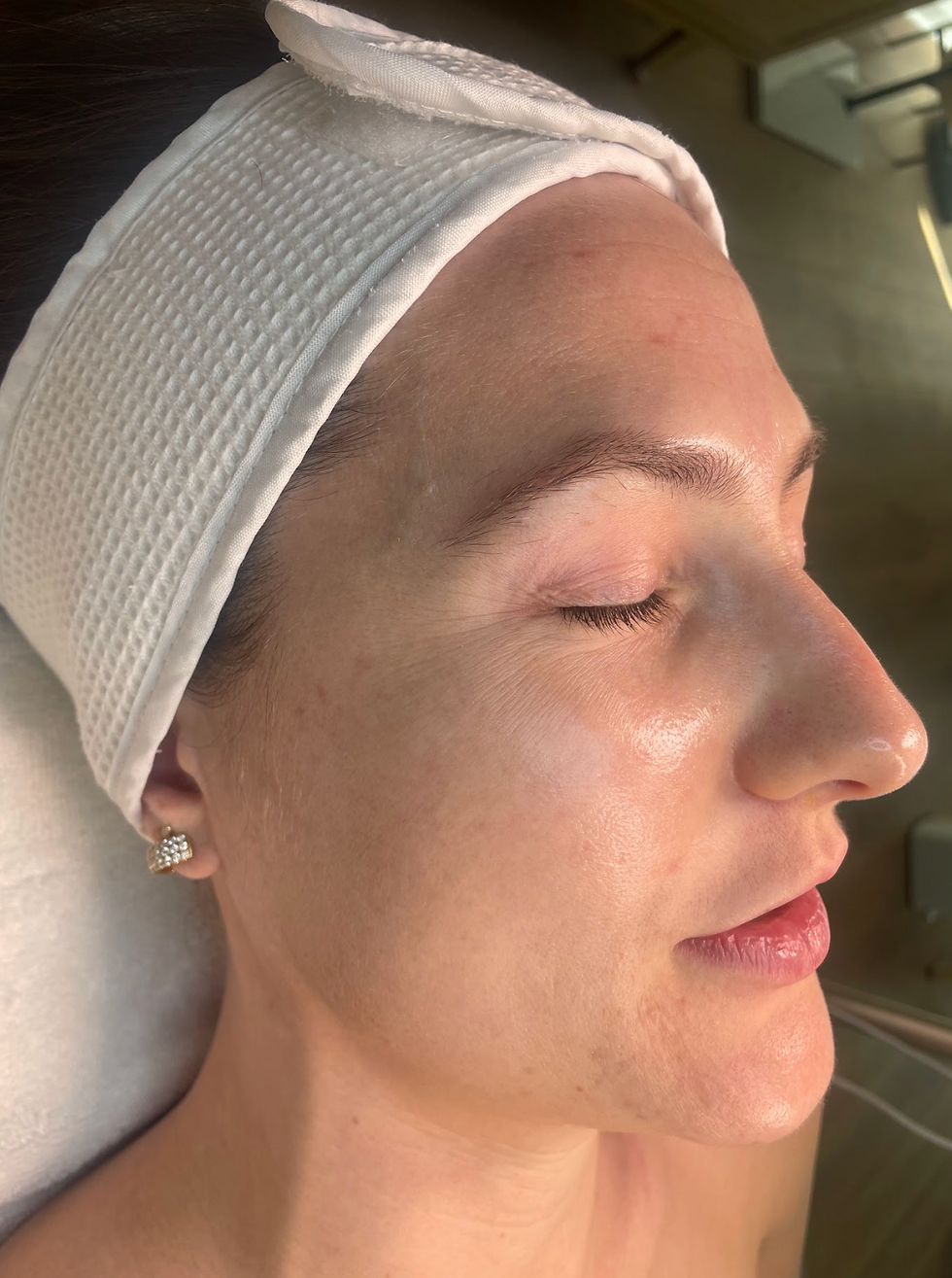 Woman receiving a facial at Transcendence Spa, eyes closed and relaxed, as Marcia performs a calming treatment in a serene setting.