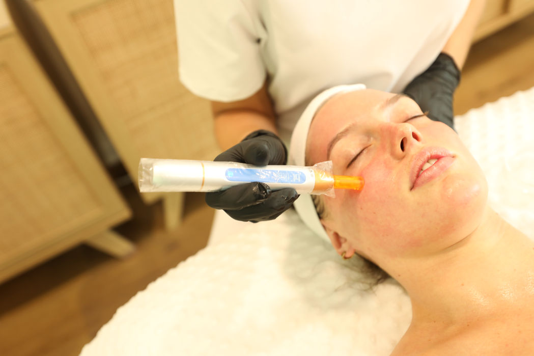 A woman receives a skincare treatment on her face in a spa setting. Technician applies product with a gloved hand. Calm atmosphere.