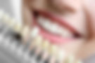 check teeth color for cosmetic dental